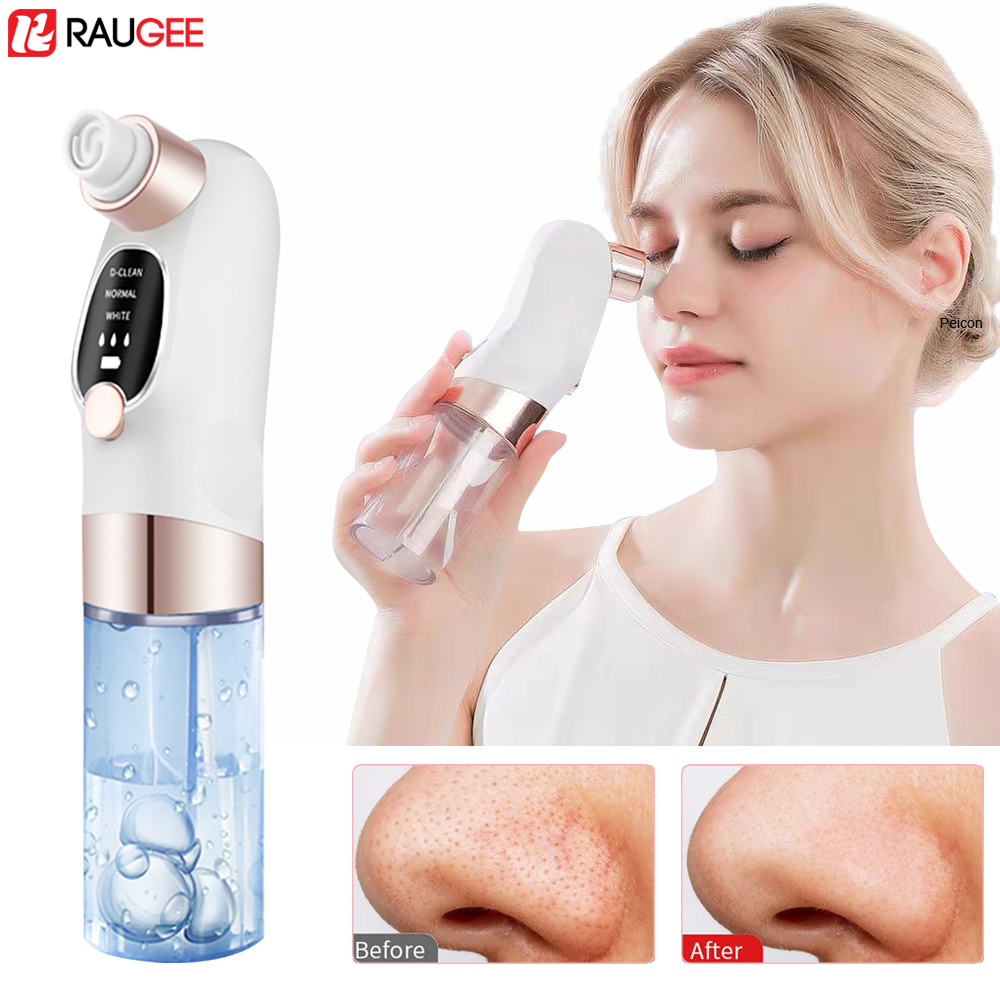 Blackhead Remover Electric Bla - Air Bubble Remover のレビューと価格