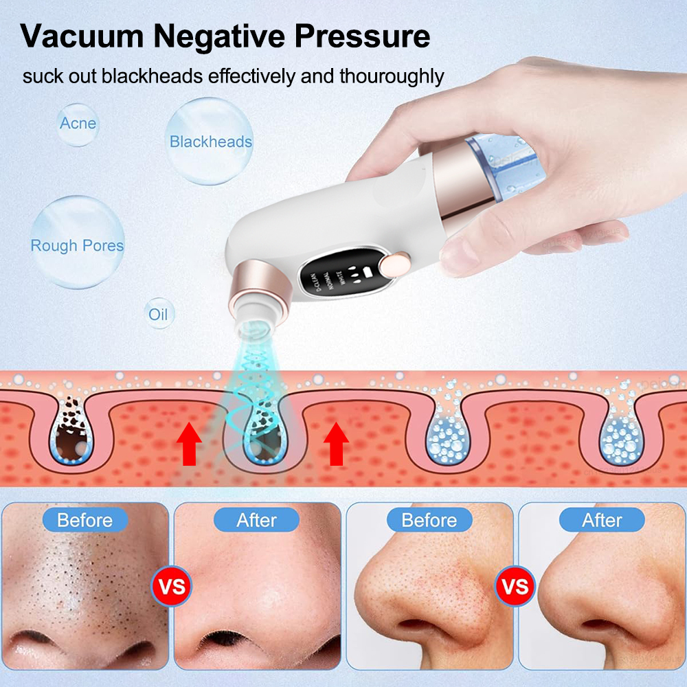 Blackhead Remover Electric Bla - Air Bubble Remover のレビューと価格